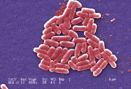 Escherichia coli bakteriestamme  O157:H7, forstørret 6.836×