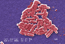 Biostone Tourmaline Fjerner også e.coli bakterier