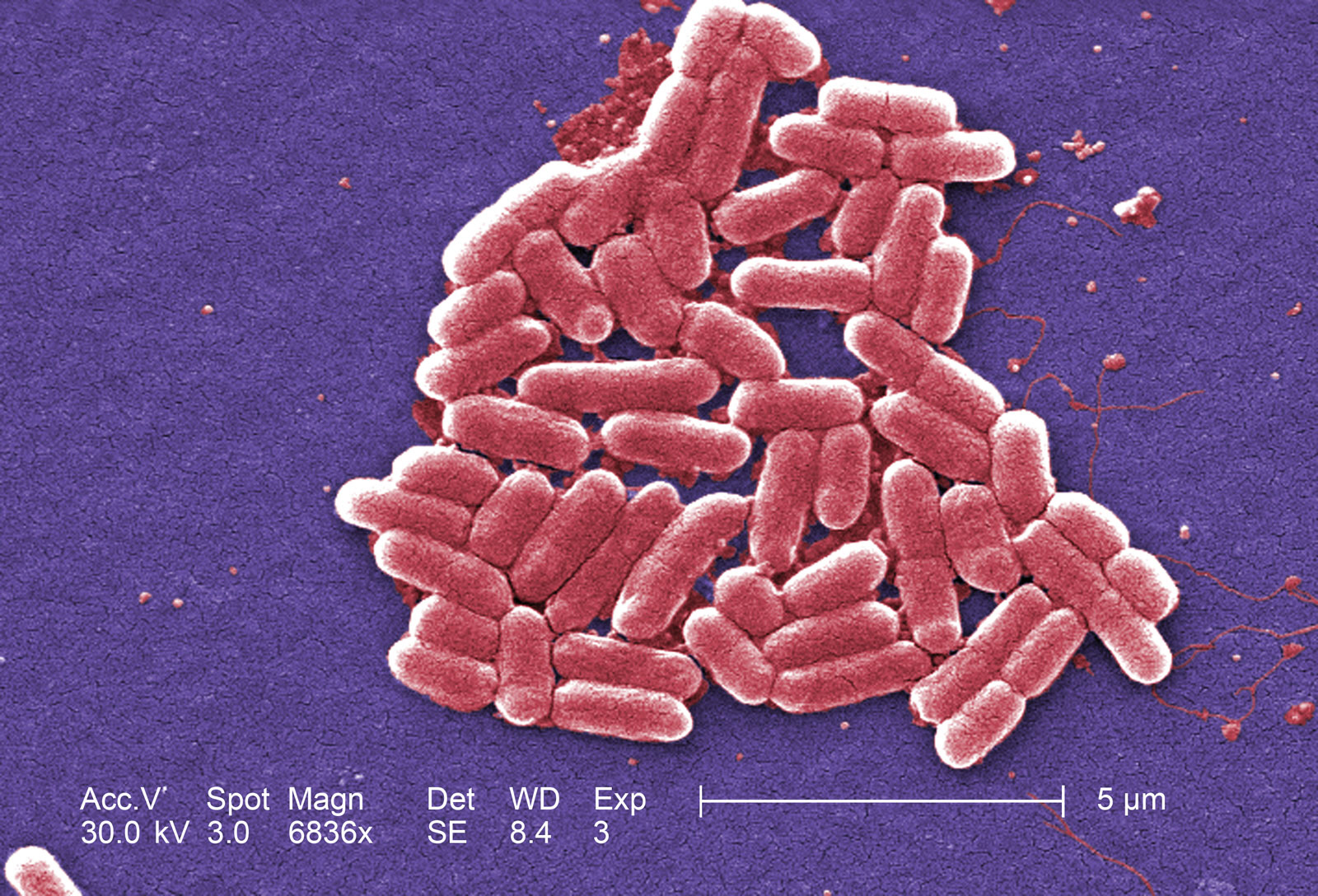 røre ved kontrol Imponerende e-coli bakterier